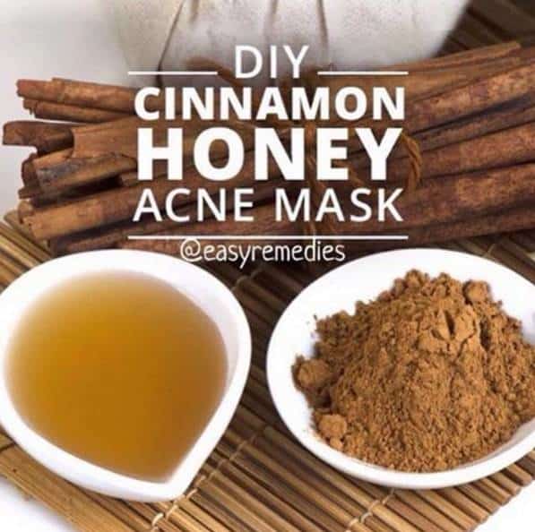 Manuka Honey Sidr Acne Face Mask Manuka Honey Sidr Acne Face Mask
