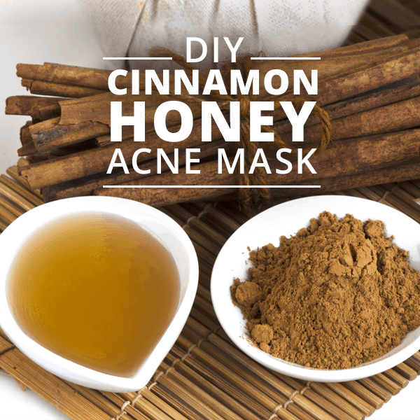 DIY CINNAMON HONEY ACNE MASK