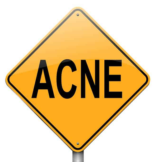 A Yellow Acne Road Sign 
