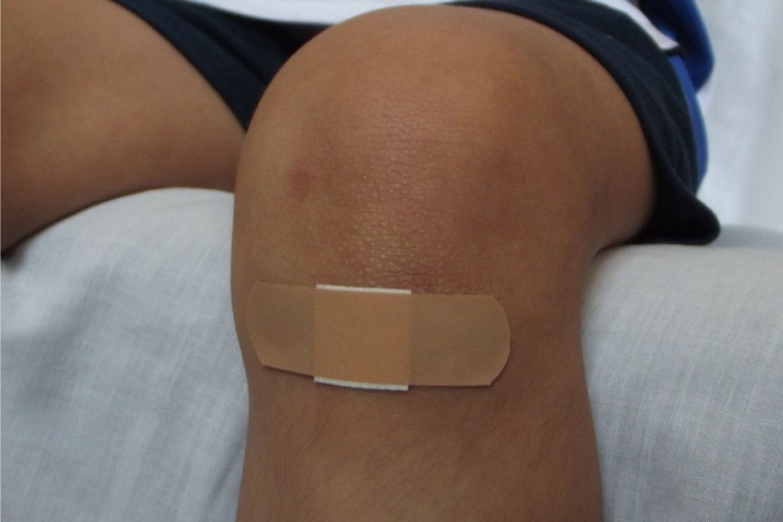 Person's knee with a band aid over a wound
