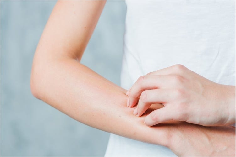 young woman scratching her skin